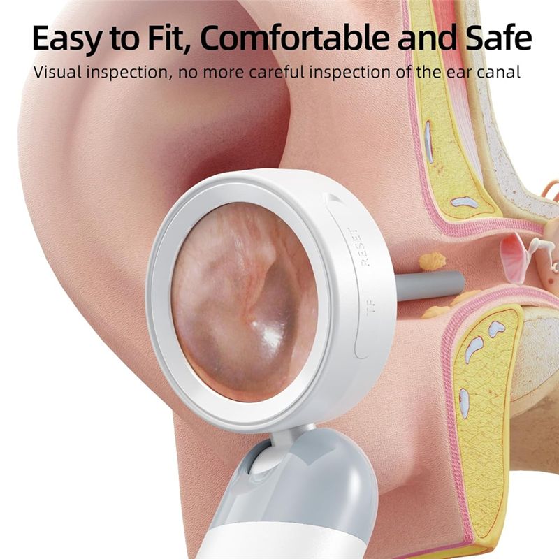 LXYB18B Wireless Ear Otoscope  - Photography Lighting Diagram recension och pris