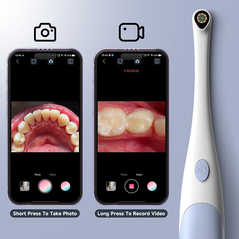 Oral Endoscope Camera 1440P Ph - Photography Lighting Diagram recension och pris